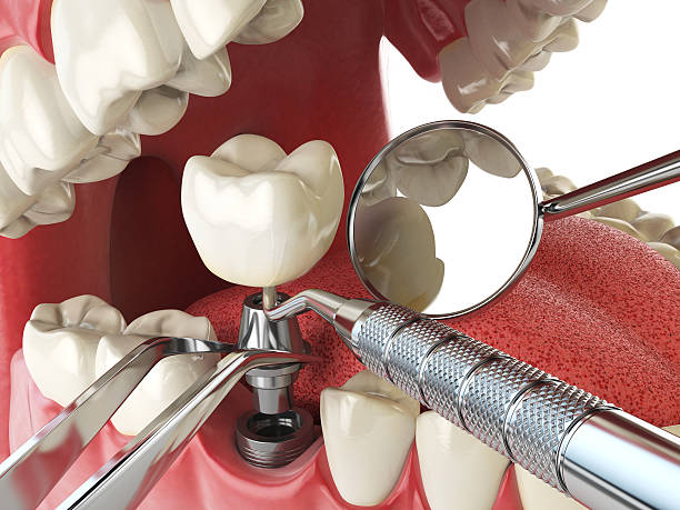 Best Emergency Broken Tooth Repair in Nd Lake, WI